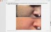 iOS 12: Apple conferma il problema del Beauty Gate su iPhone XS