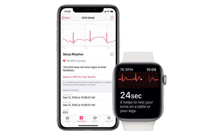 watchOS 5.1.2, ECG, Apple Watch Series 4