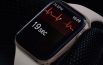 Il lettore ECG di Apple Watch MIGLIORERÁ per TUTTI
